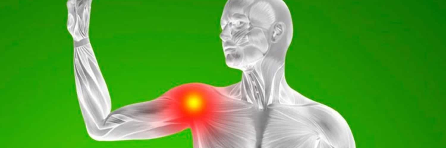 Tendinitis del supraespinoso: síntomas, prevención y cura
