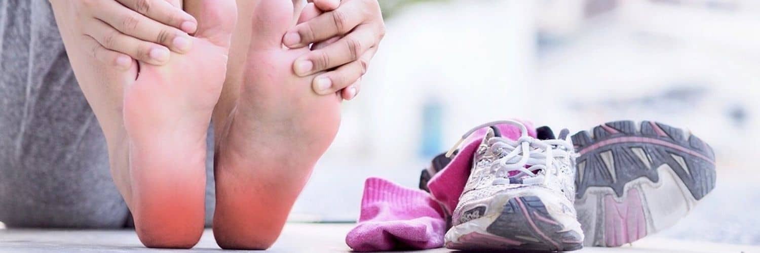 Fascitis plantar: ponle solución | Tratamiento y prevención